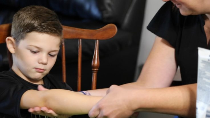 AJ Grady will celebrate his 6th birthday in October. After having eczema as a baby, AJ later developed food allergies. They are part of a chain reaction of allergic diseases called the atopic march and a new study by National Jewish Health finds it’s more common in babies born in the fall.